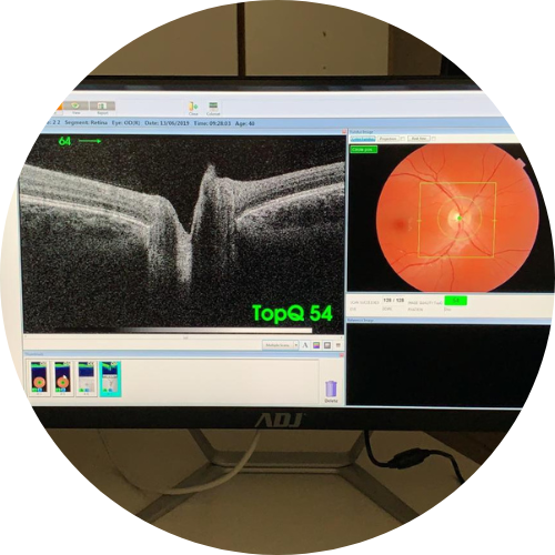 OCT Retinografo Topcon Maestro